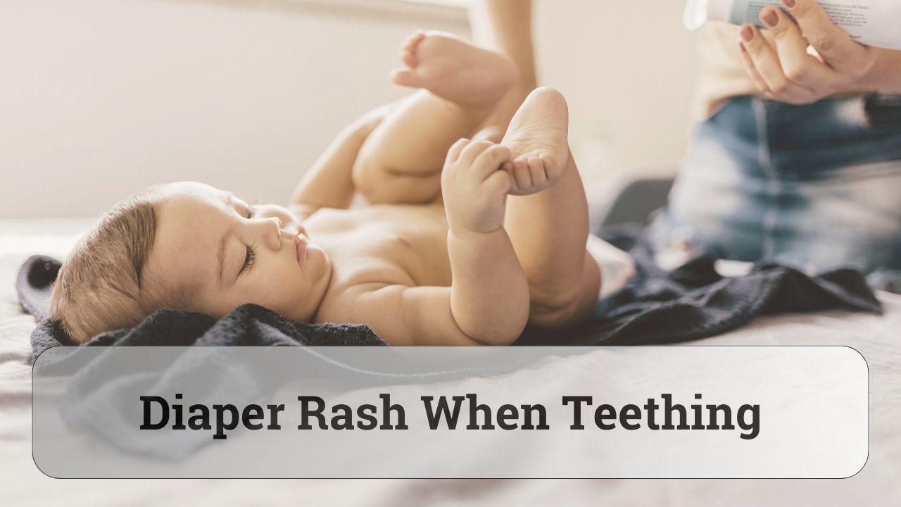 diaper rash when teething tips - how to prevent diaper rash